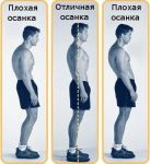 Ортопедический корректор (не корсет) для исправления осанки. Коррекция осанки.